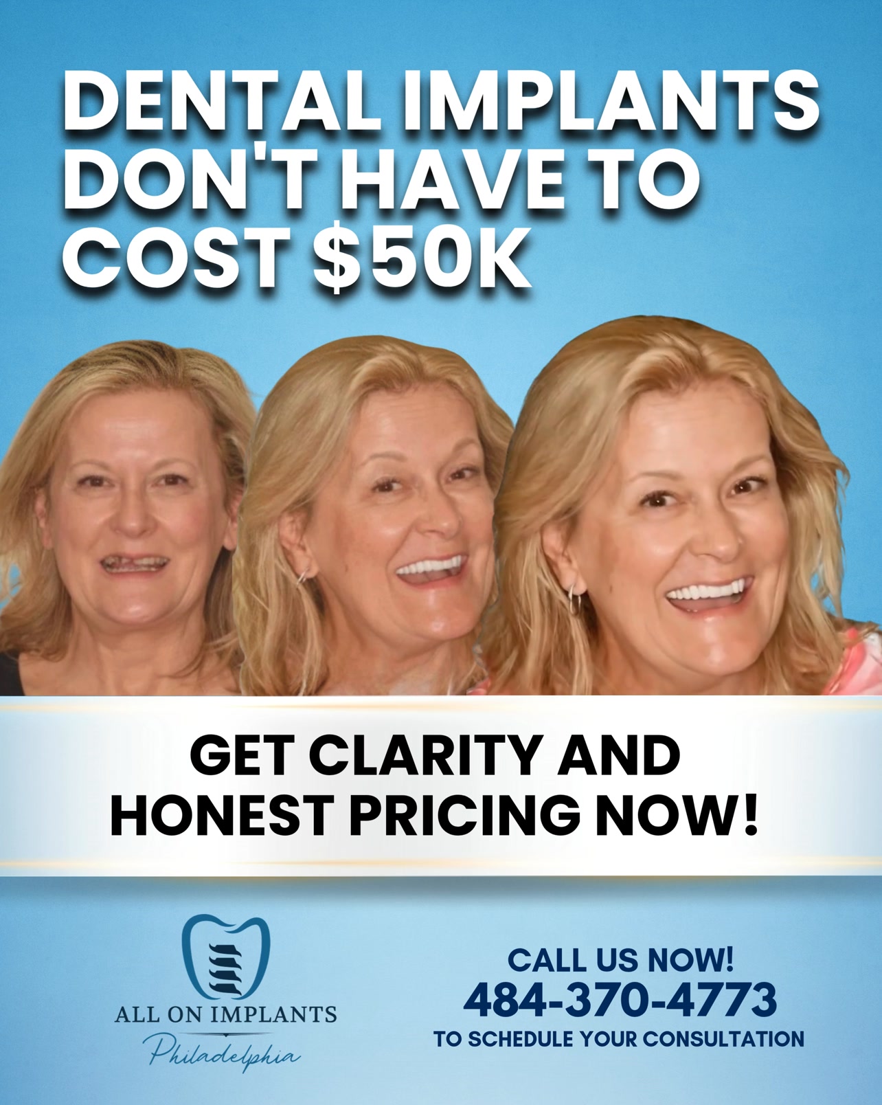 Dental Implants Don’t Have to Cost $50K