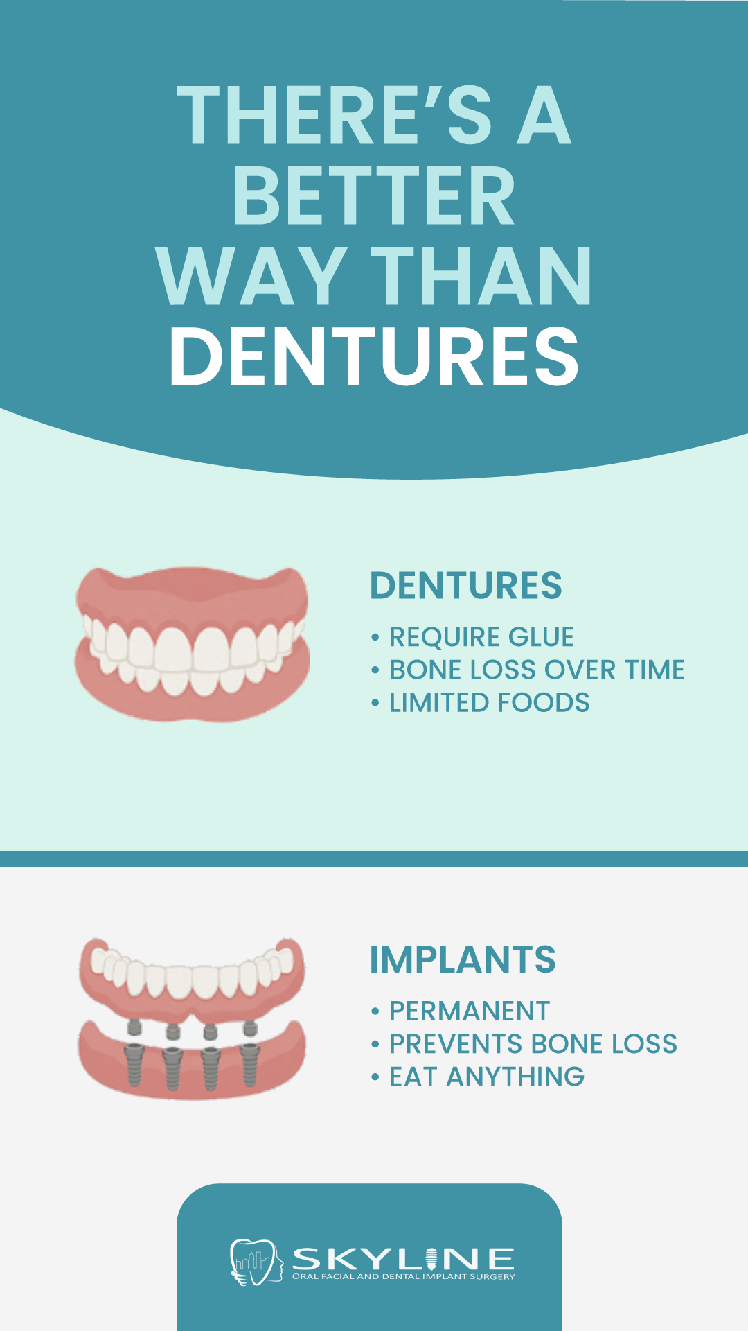 Why All-on-Four Implants Outperform Dentures 🦷
