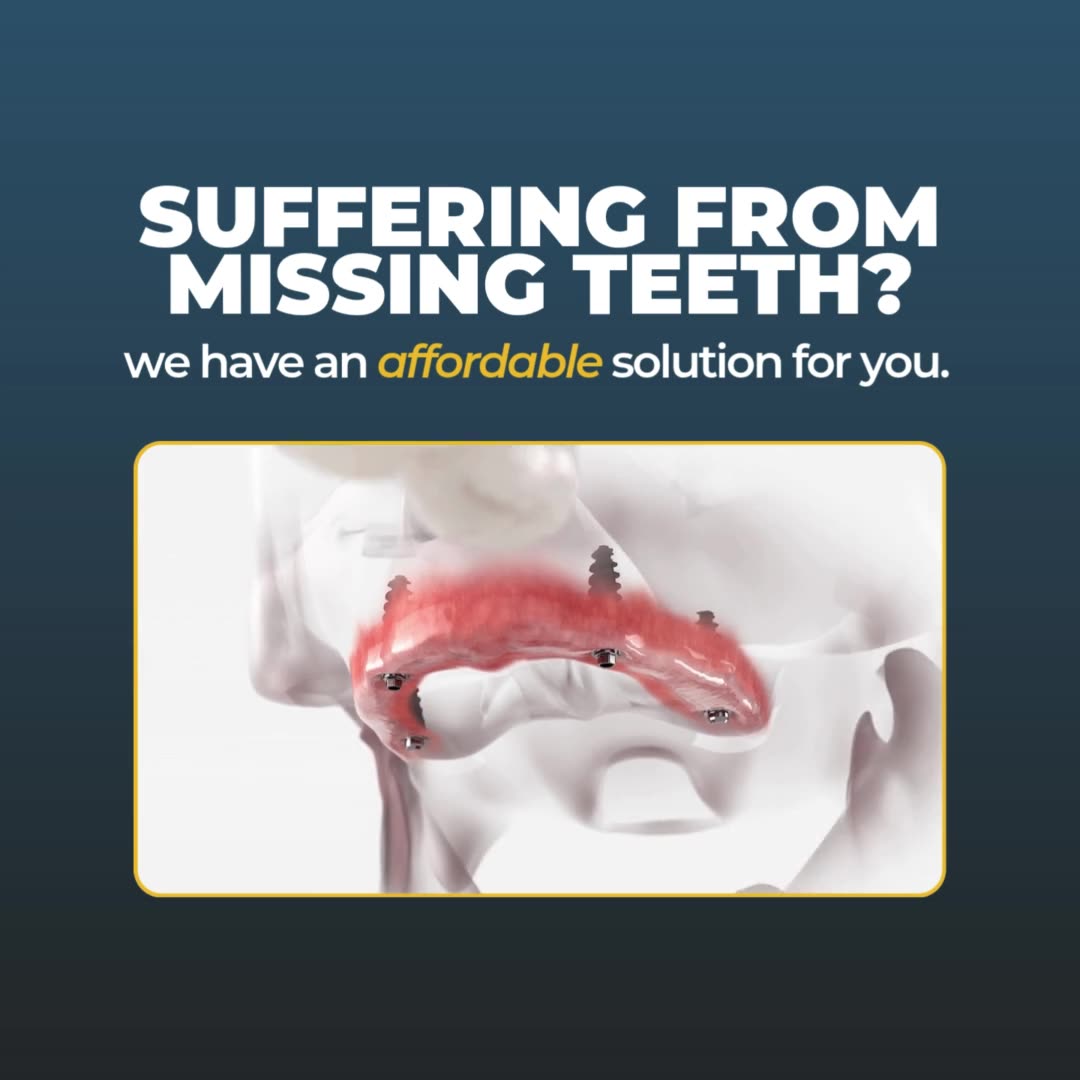 Mesa Implants & Periodontics, LLC General Dentist ad creative