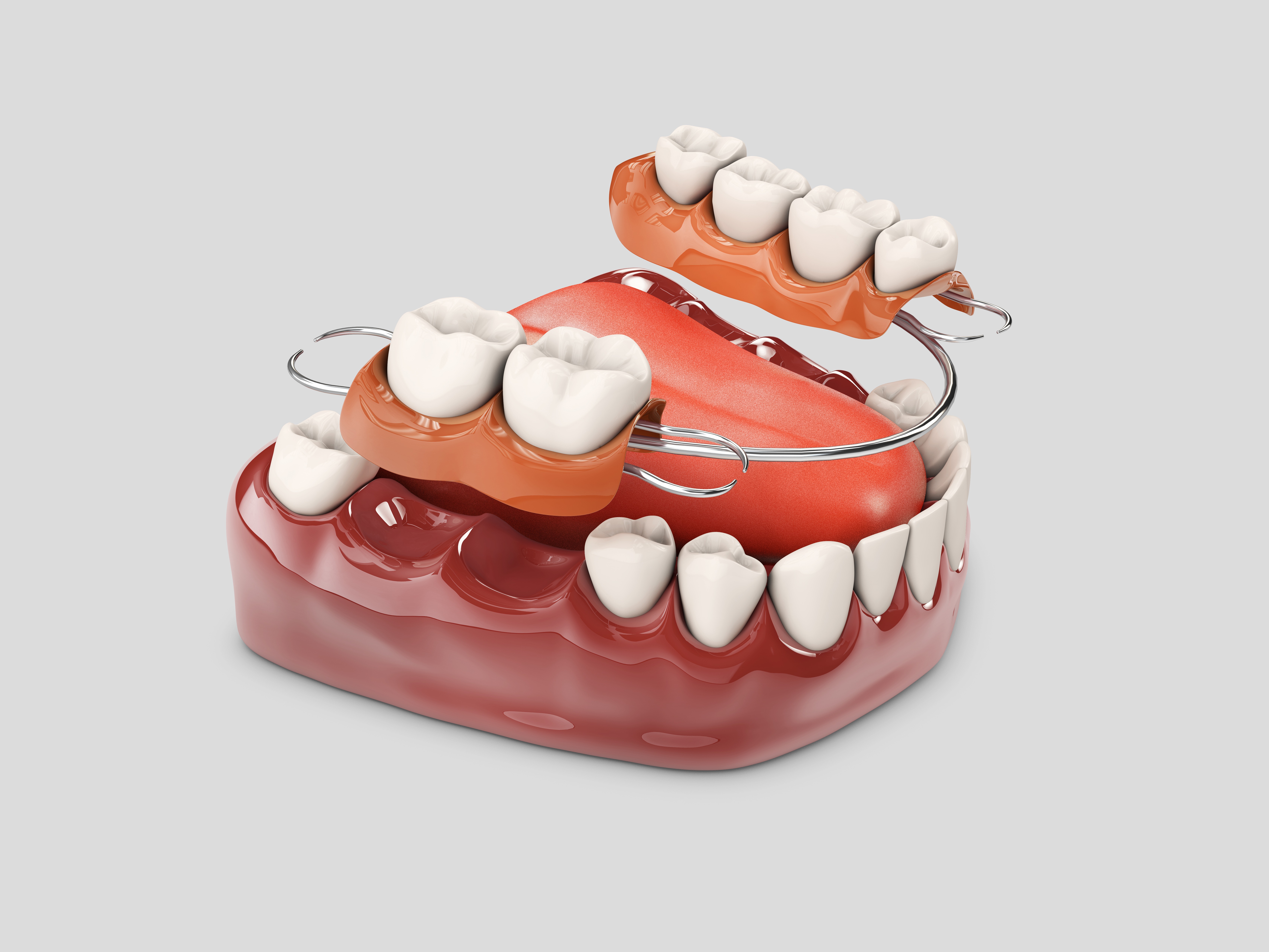 Limited to 50 Patients: VIP partial denture promotion! 😍