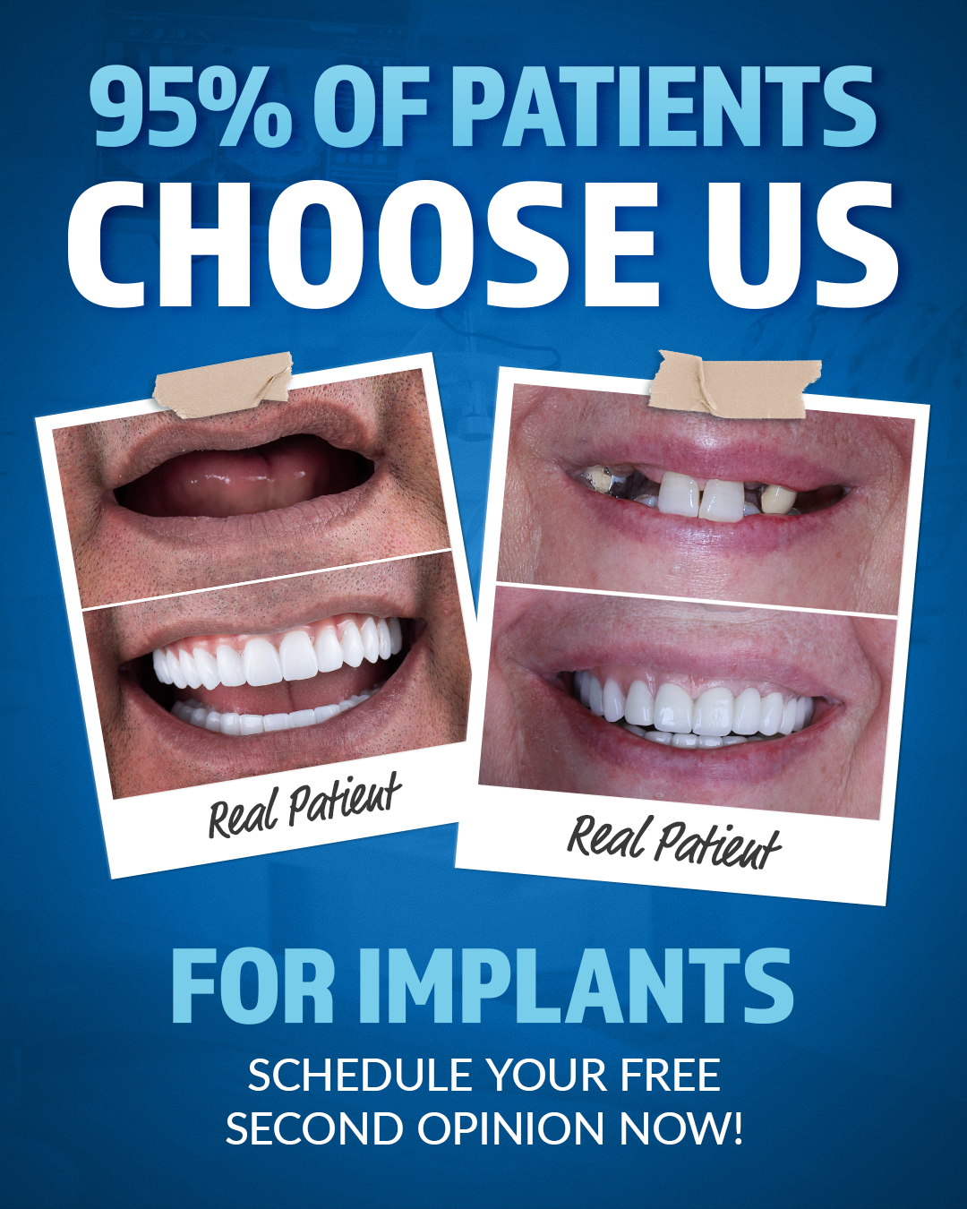 Think $60K Is Normal for Implants? Think Again! 💸