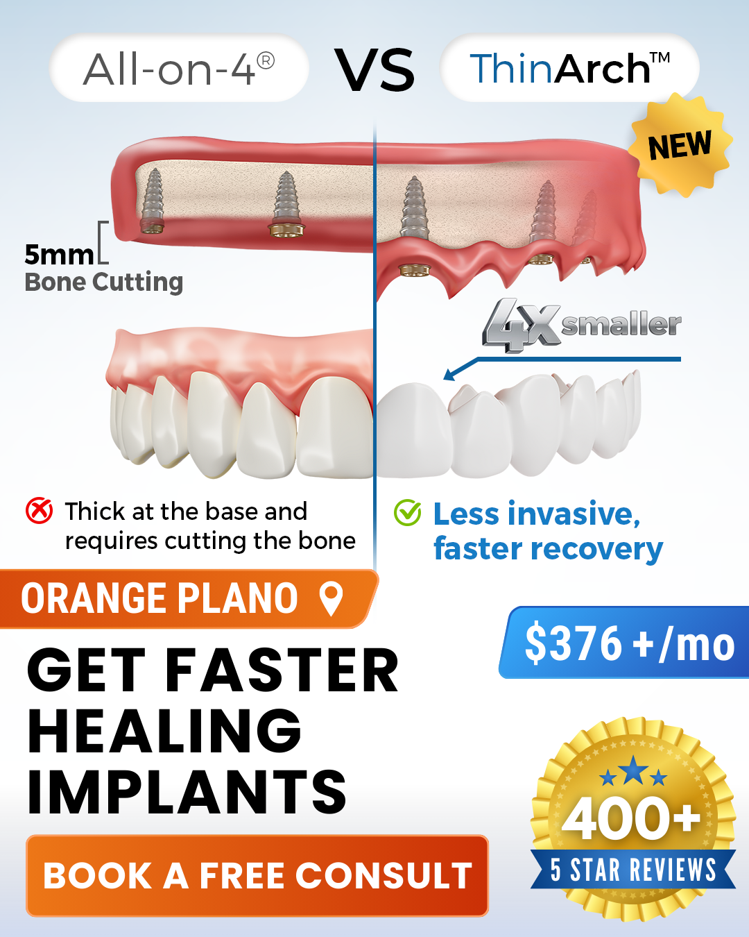 Texas Implant & Dental Specialists Implant Dentist ad creative