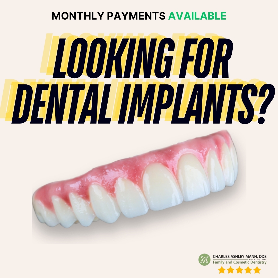 Charles Ashley Mann, DDS & Associates Implant Dentist ad creative