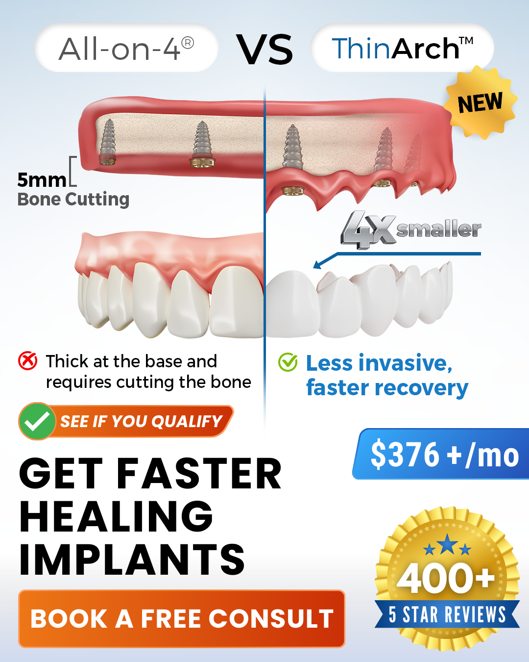 Do you qualify for ThinArch? ❤️ Reserve Your Consult 👉