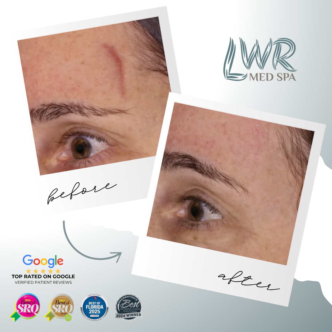 Lakewood Ranch Med Spa Med Spa ad creative