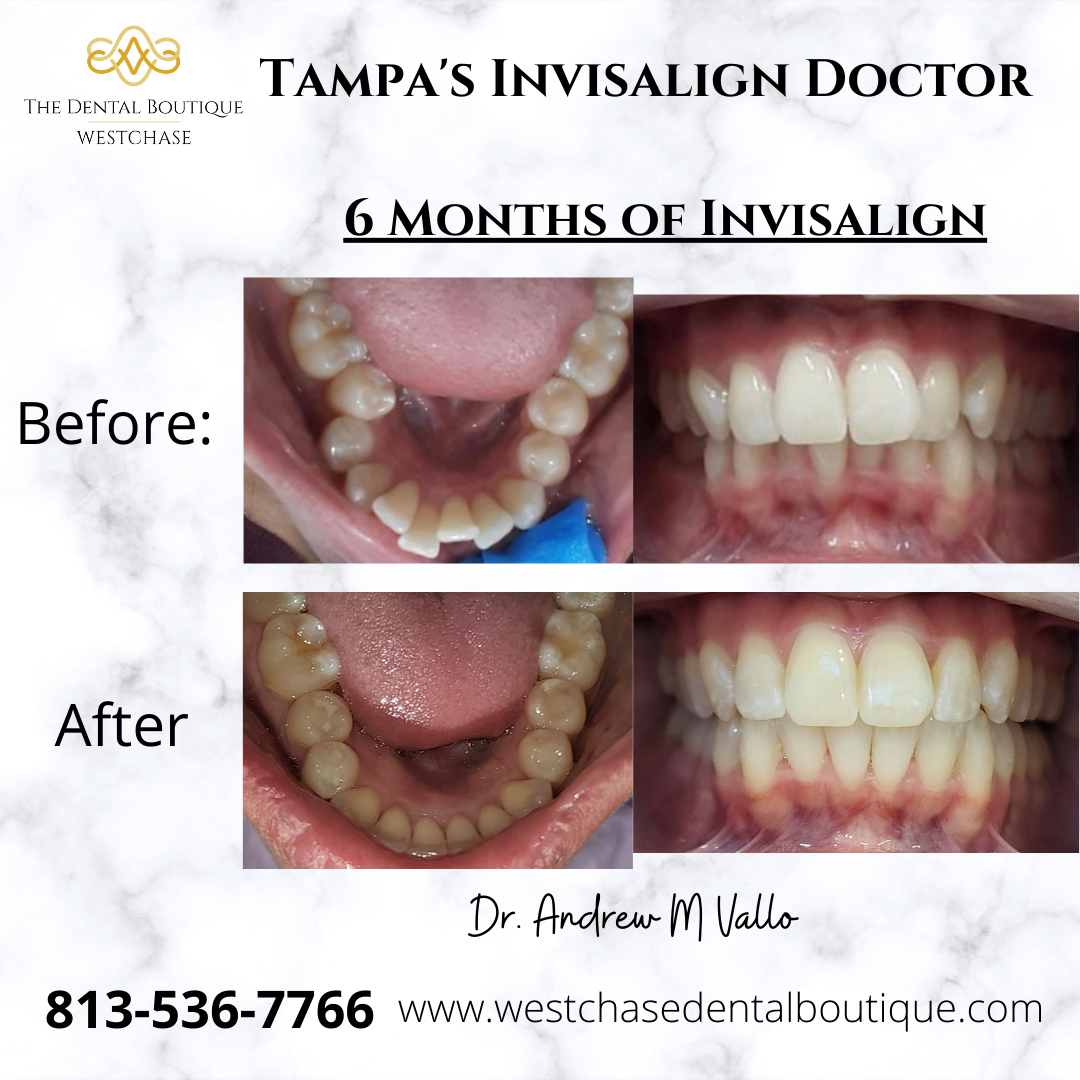 The Dental Boutique Westchase Cosmetic Dentist ad creative