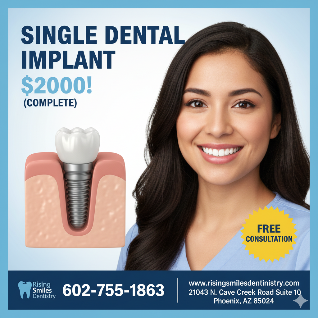 Rising Smiles Dentistry Implant Dentist ad creative