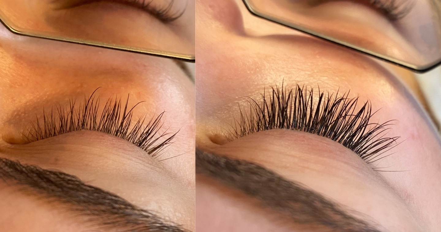 Jordyn Lee Aesthetics Med Spa ad creative