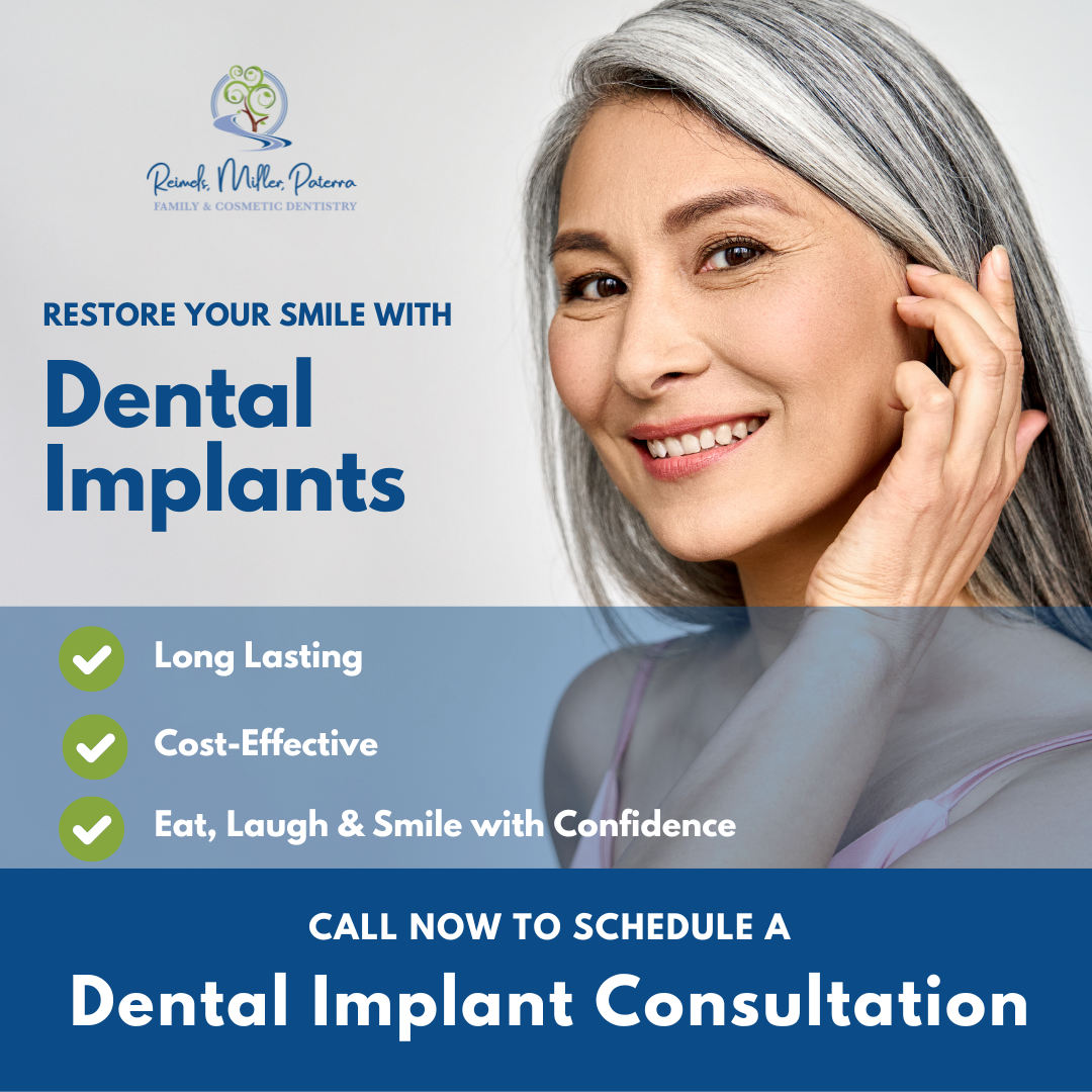 Achieve Your Ideal Smile with Dental Implants