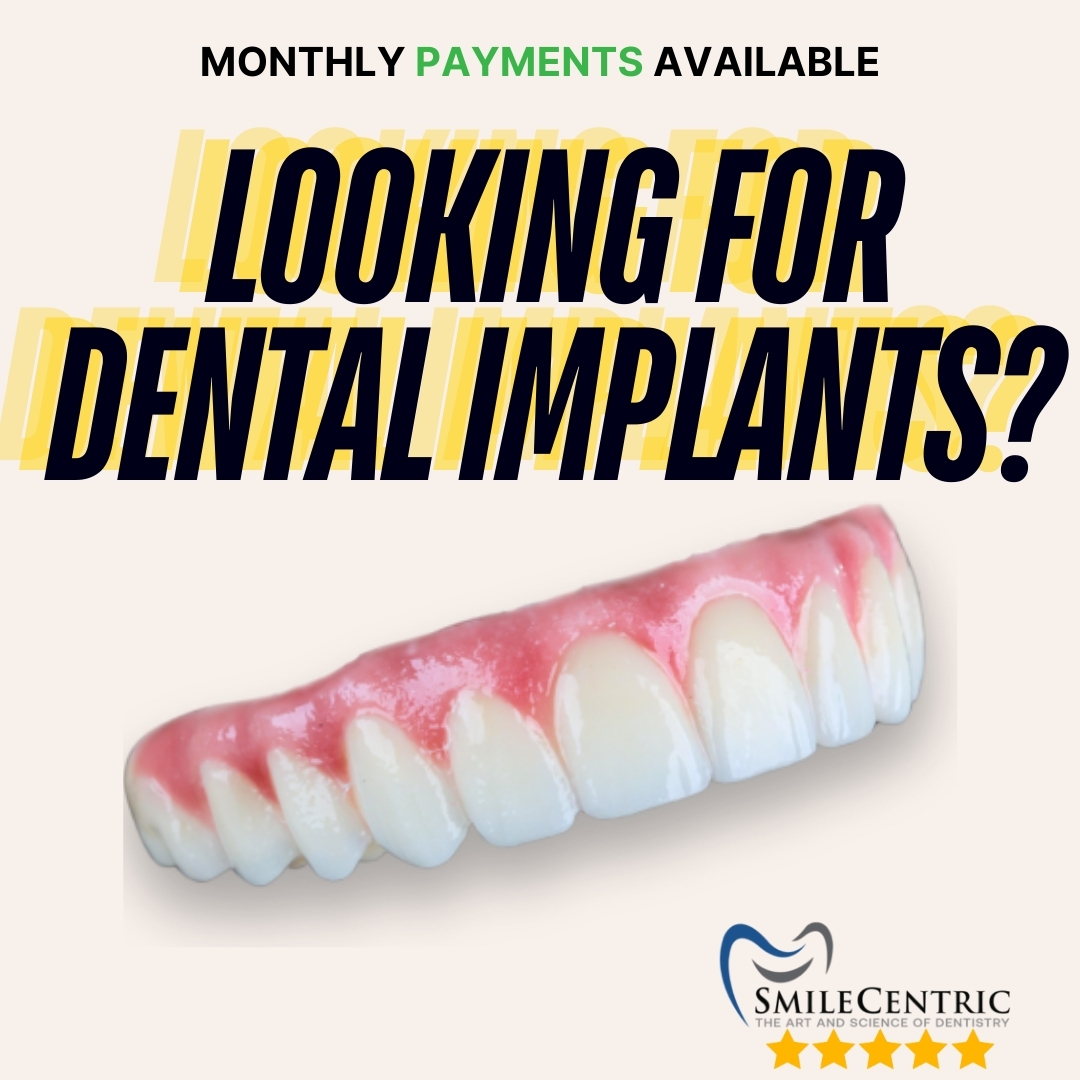 SmileCentric - Cosmetic Dentist & Dental Implant Center Implant Dentist ad creative