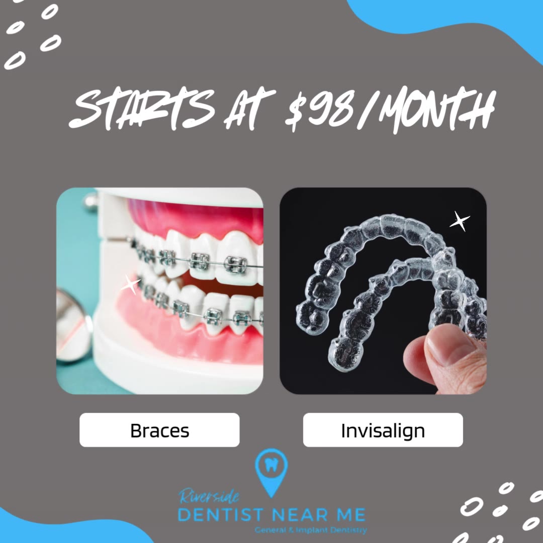 As Low As $98/month for Braces or Invisalign