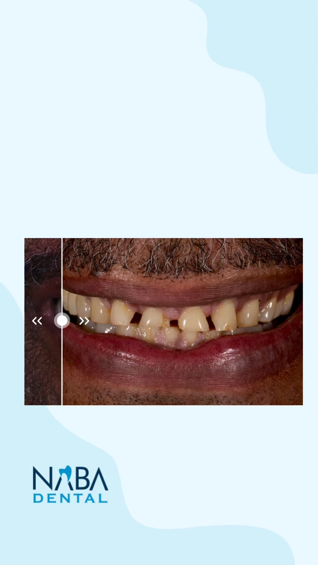 👉 FREE Consultation or $125 OFF