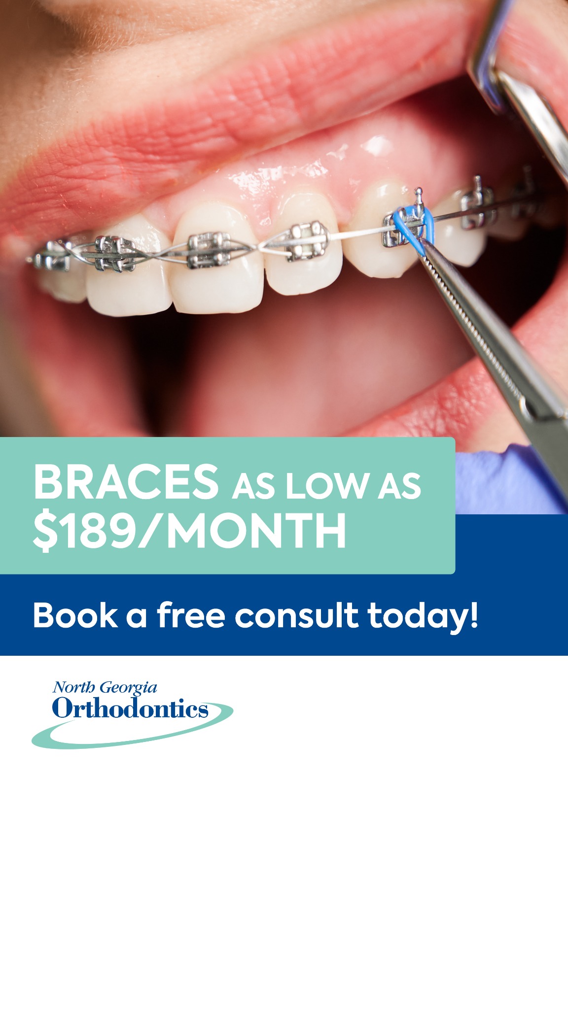 Braces As Low As $189/Mo 🦷