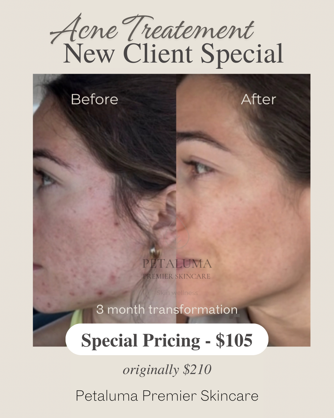 Petaluma Premier Skincare Med Spa ad creative