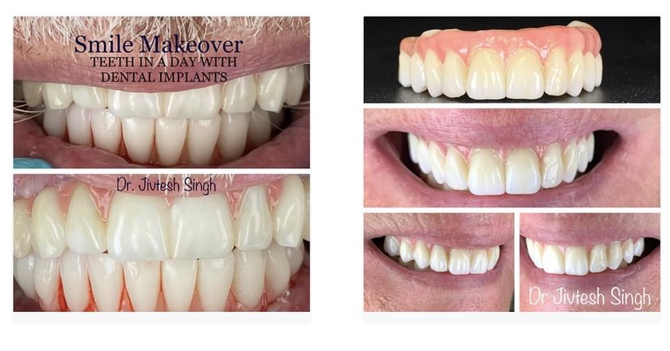 A & B Dental - Advanced Cosmetic and Implant Dentistry Cosmetic Dentist ad creative