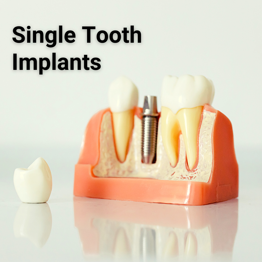 West River Dental Implant Dentist ad creative