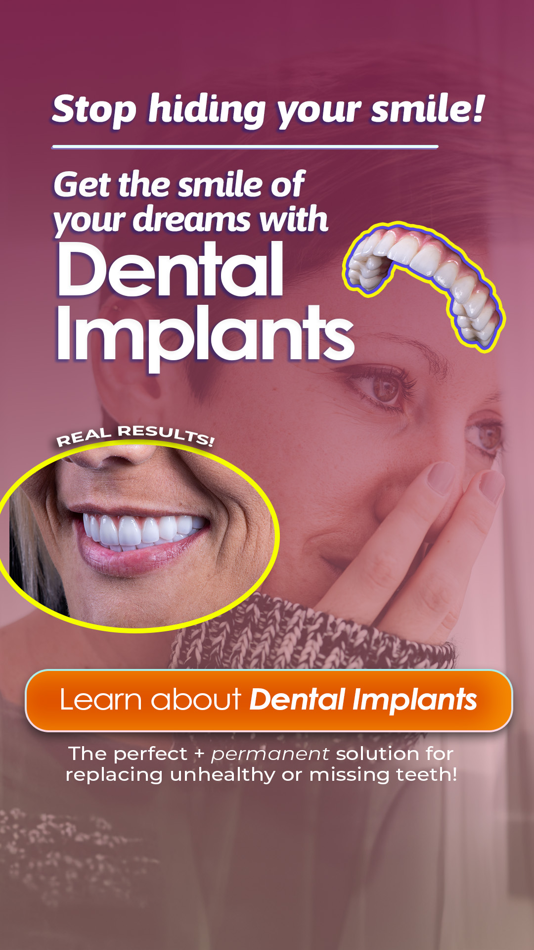 Dental Implant Center of Royal Oak Implant Dentist ad creative