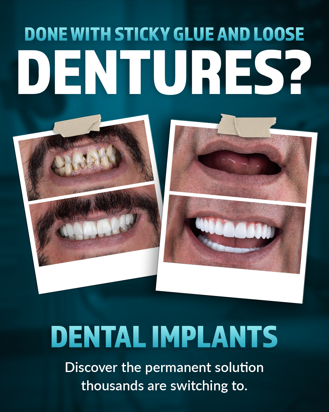 Take Our 20-Second Implant Quiz! 👉