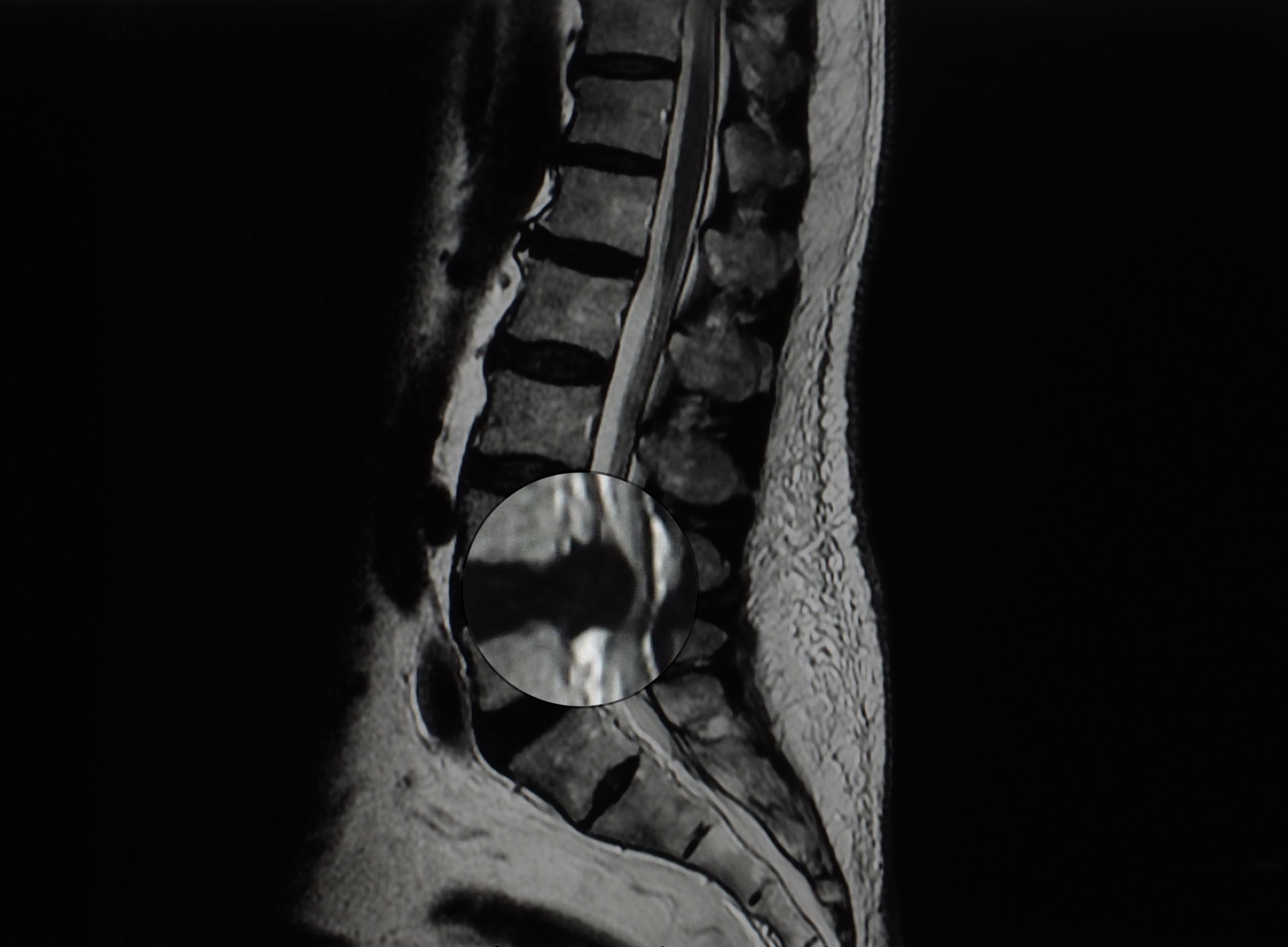 Crossroads Brain & Spine Chiropractor ad creative