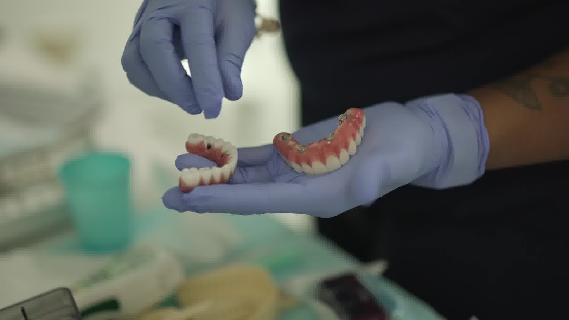 The Ultimate Guide To Dental Implant Prices