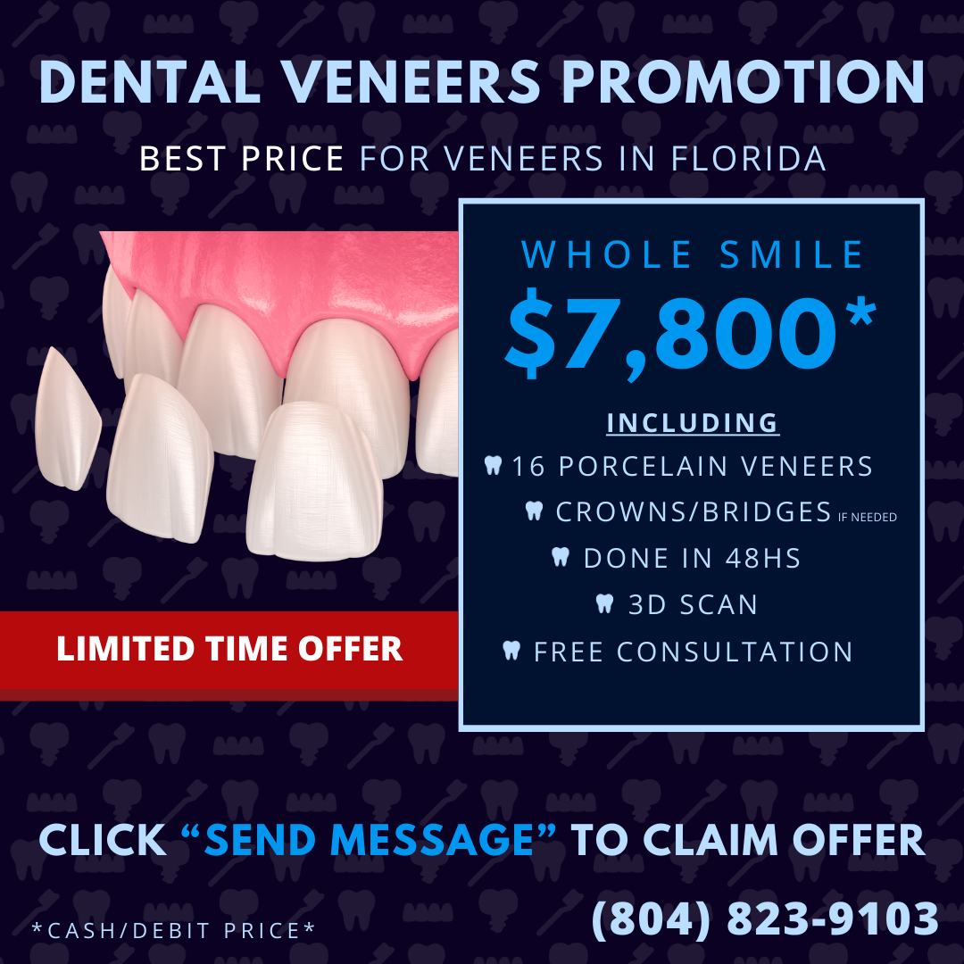Best Veneers Price in Virginia