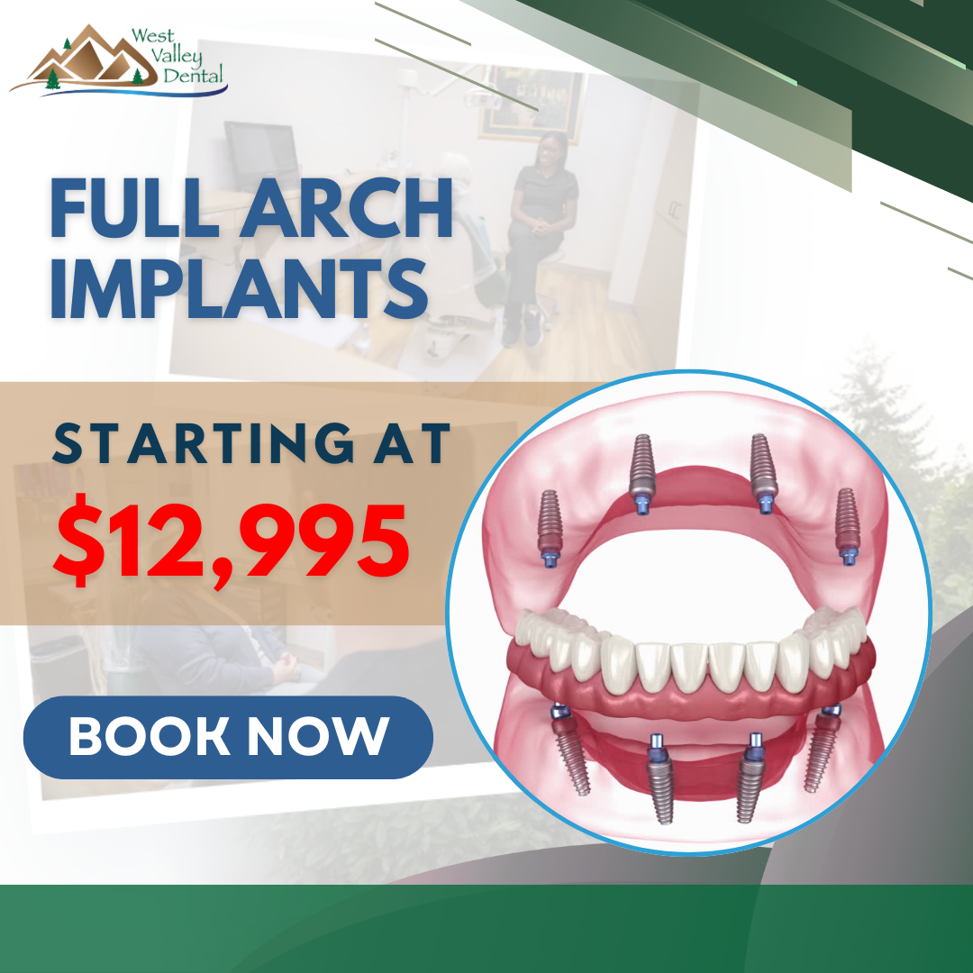 Transform Your Smile with Full Arch Implants – Starting at $12,995!