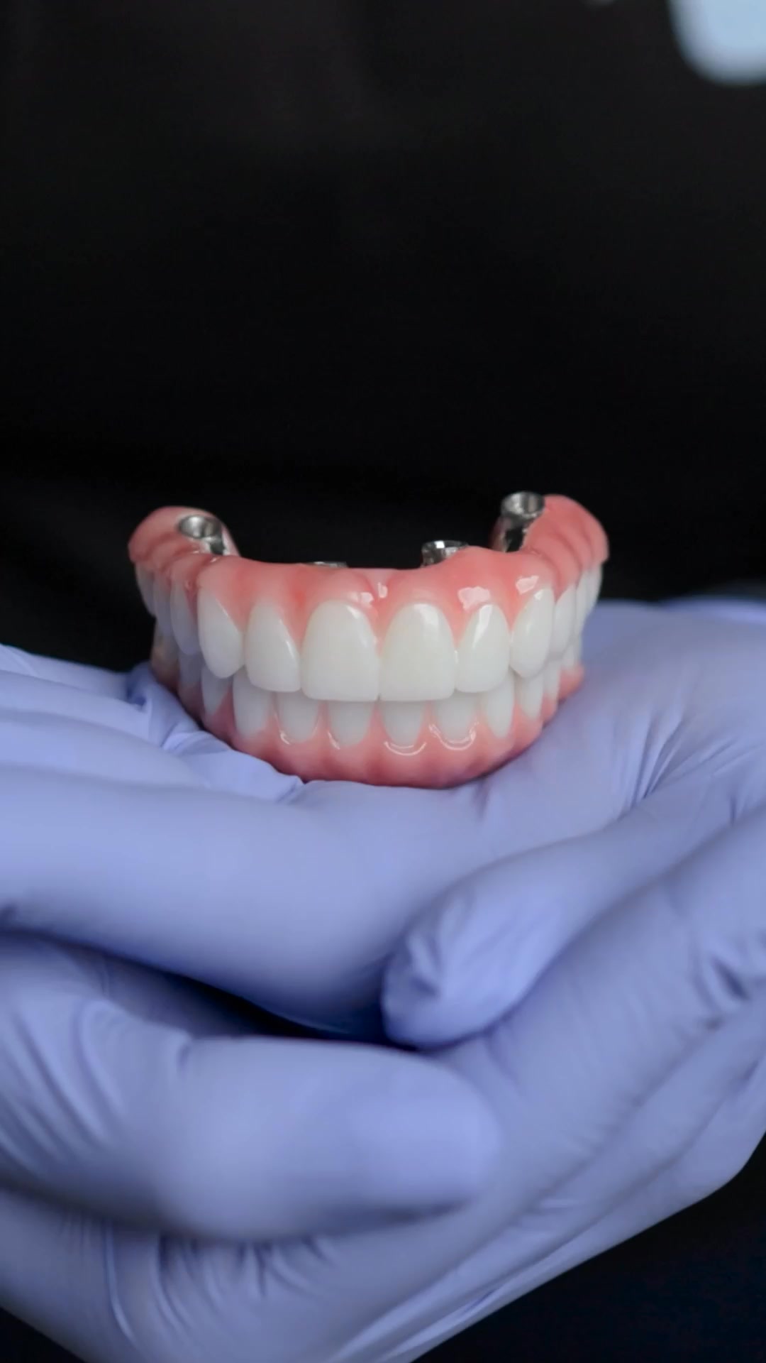 New Permanent Teeth Are Just 24 Hours Away!