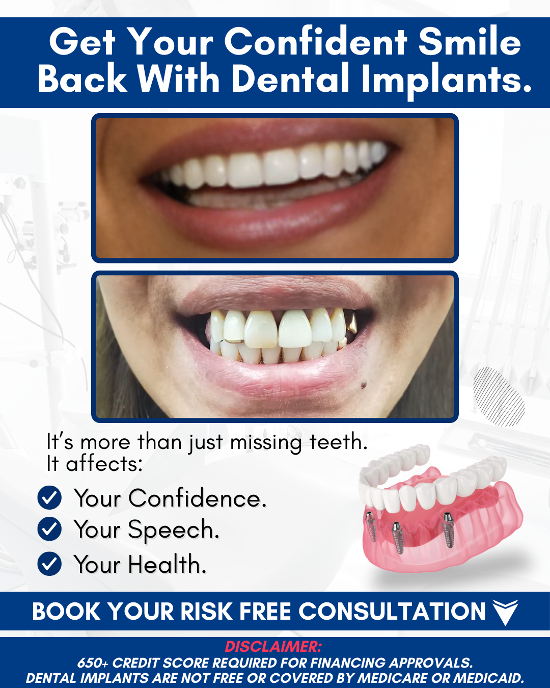 Salt Lake Dental Implant Dentist ad creative