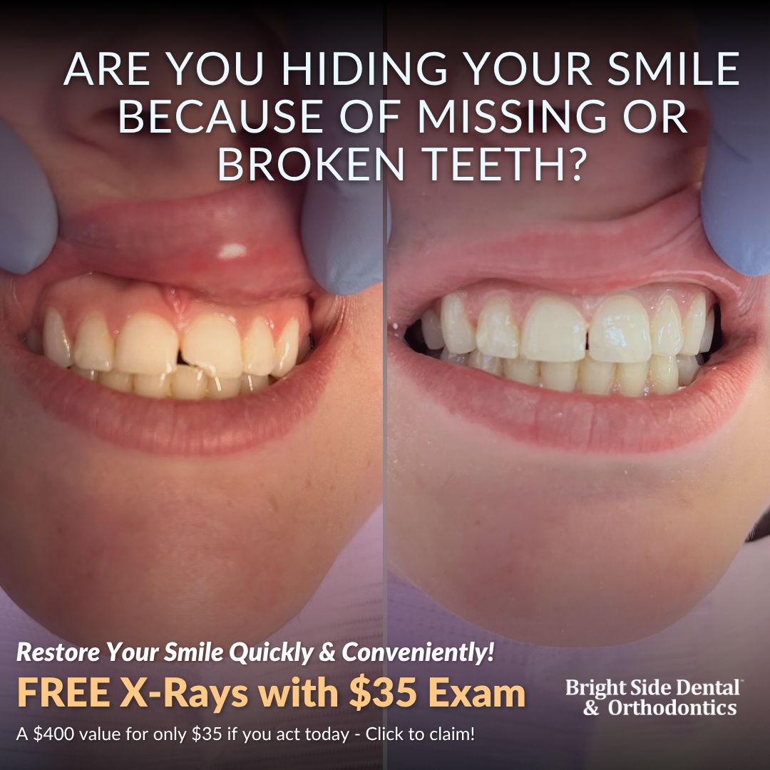 Bright Side Dental General Dentist ad creative