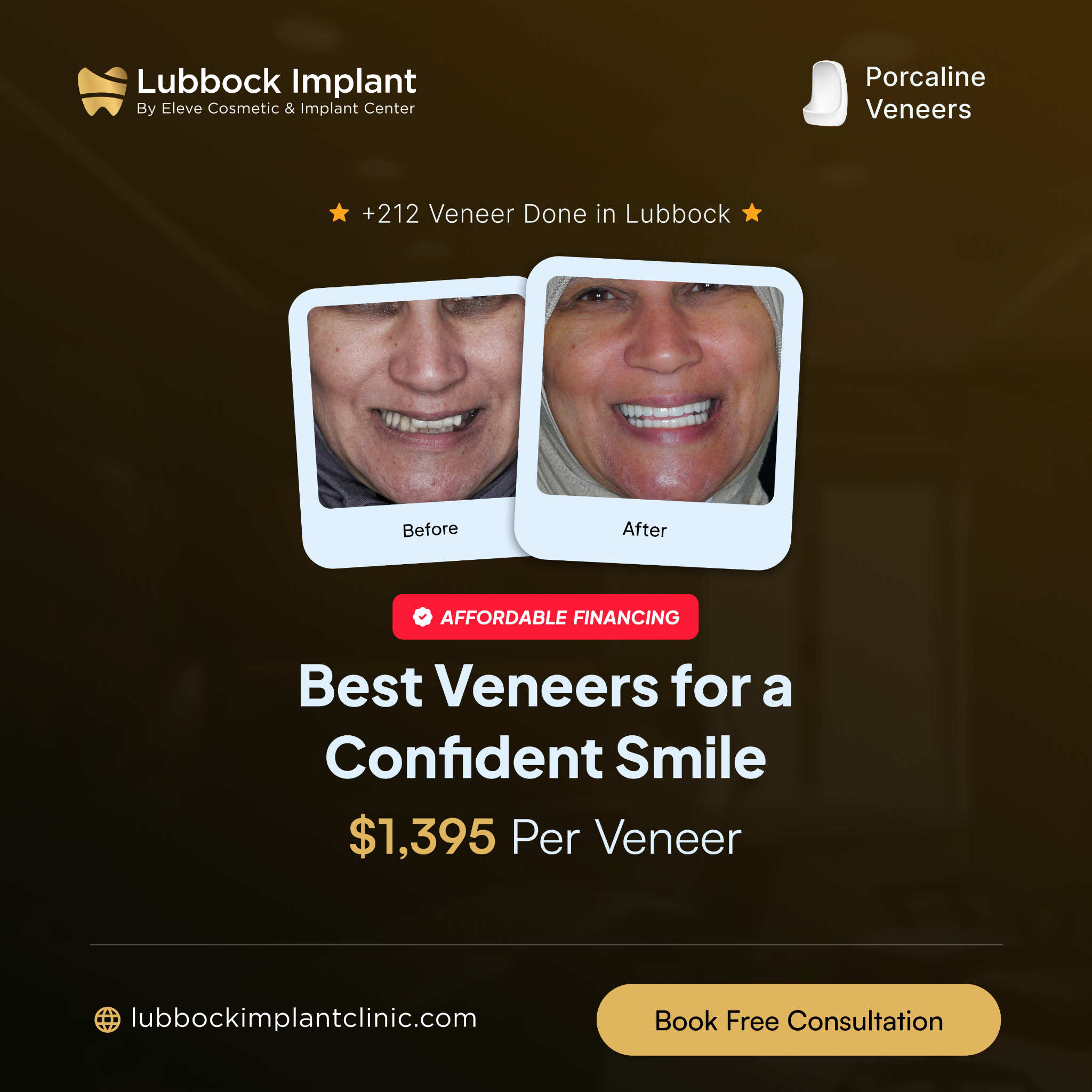 Lubbock Implant Clinic Cosmetic Dentist ad creative