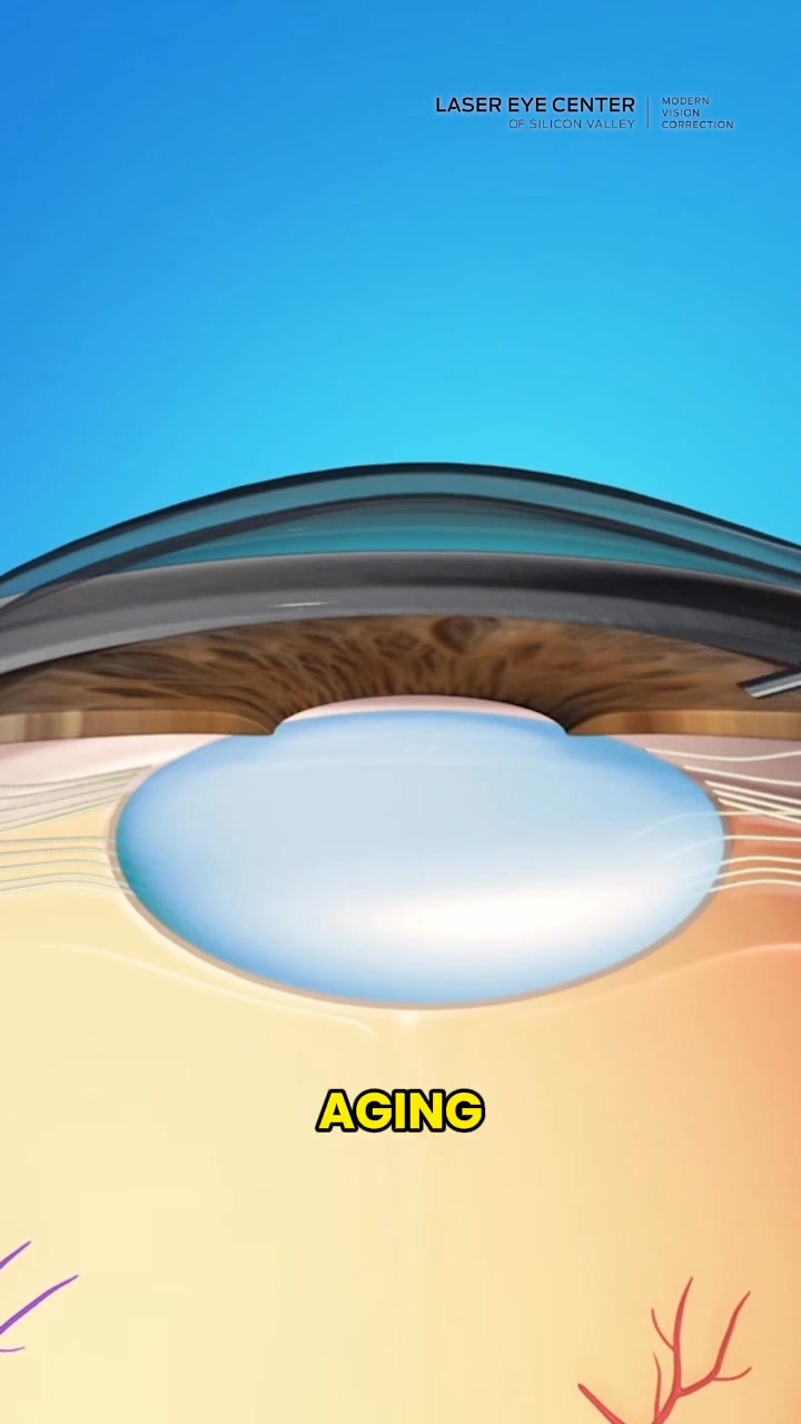 Your First Step to Effortless Vision