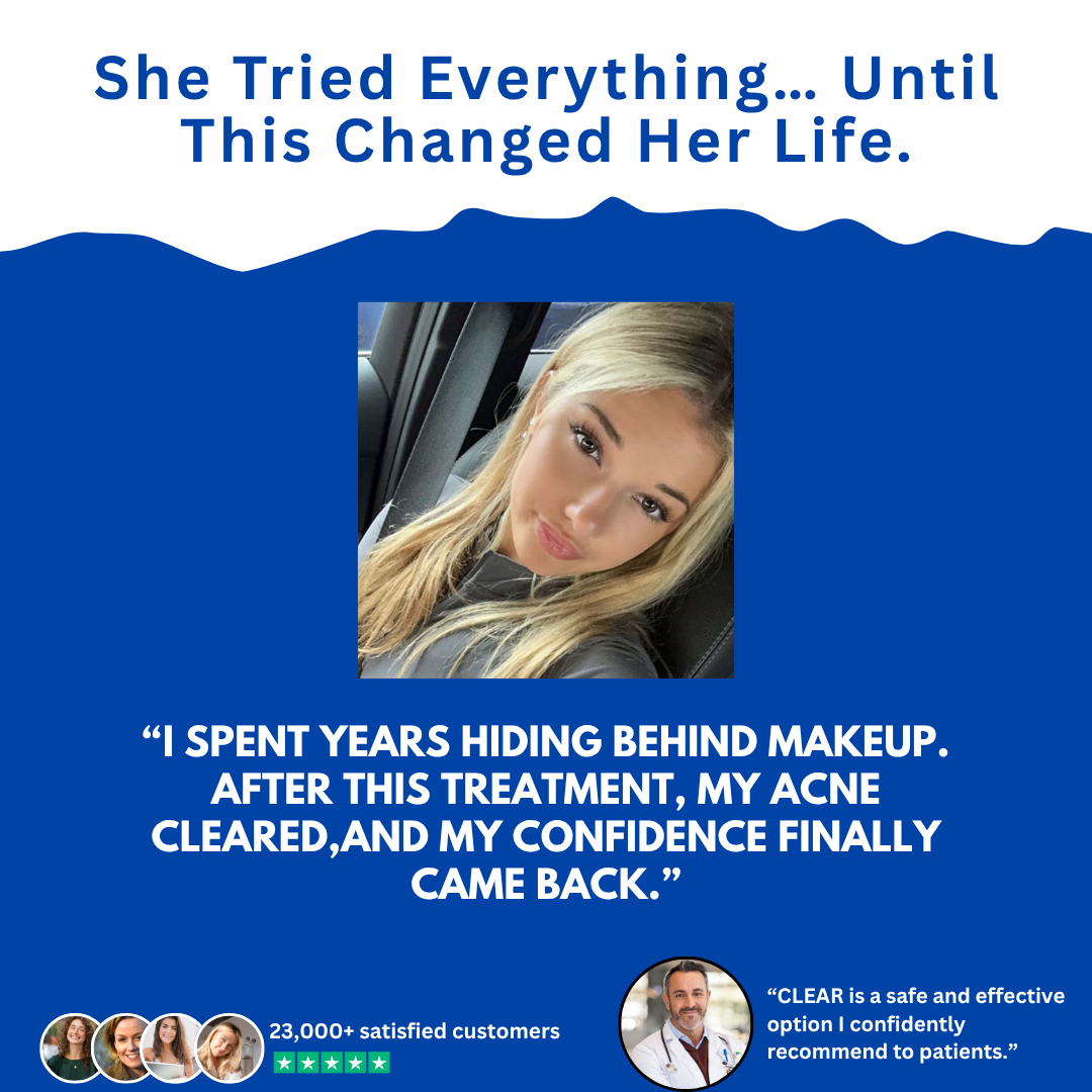 CLEAR Acne Treatment Centers Dermatologist ad creative