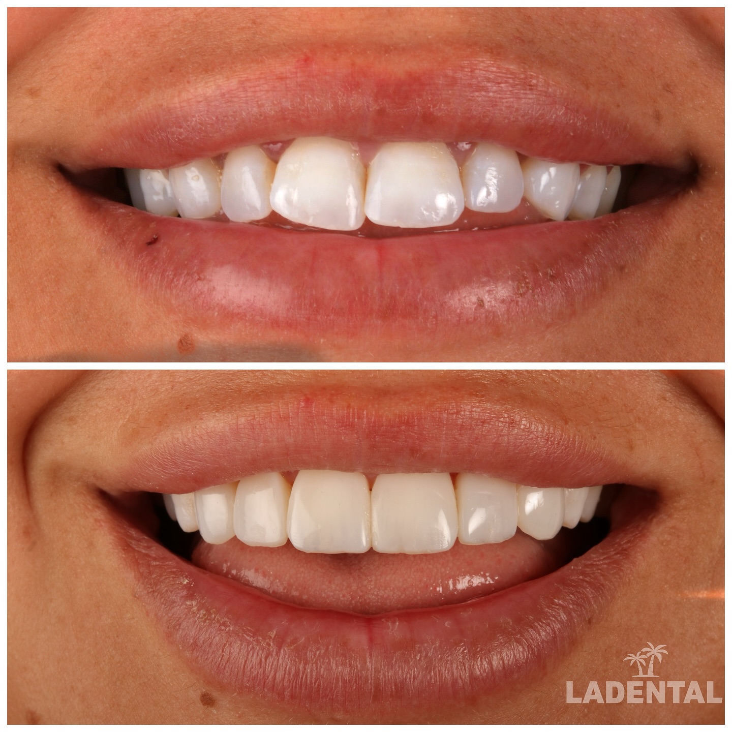 L.A. Dental Clinic Cosmetic Dentist ad creative