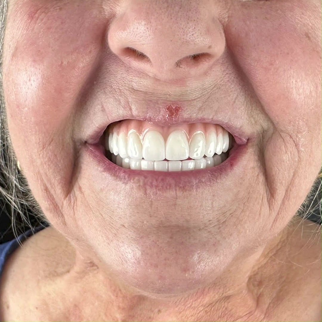 Smileology Dentistry Implant Dentist ad creative