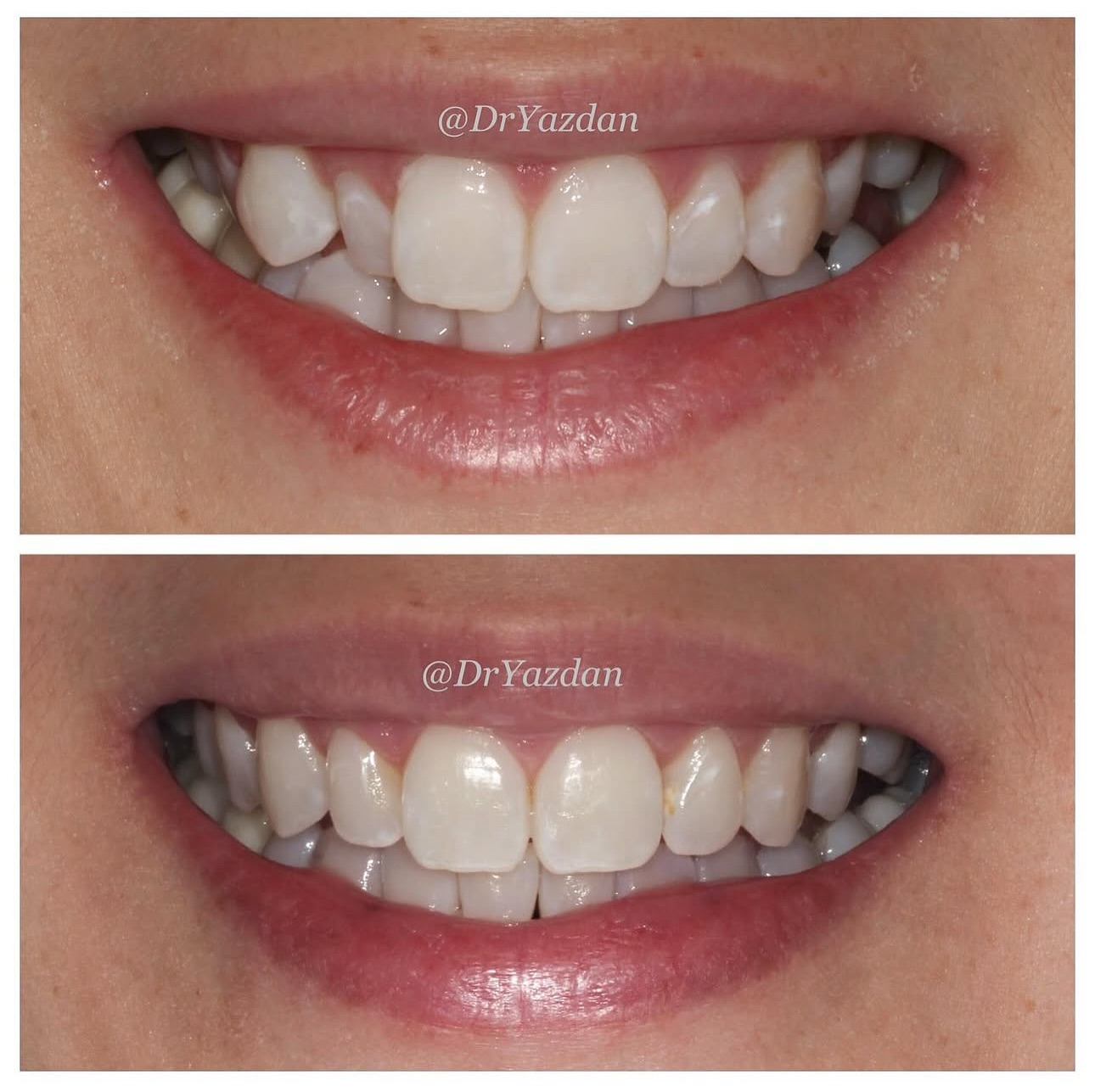 Dr. Desiree Yazdan (Dentist) Orthodontist ad creative