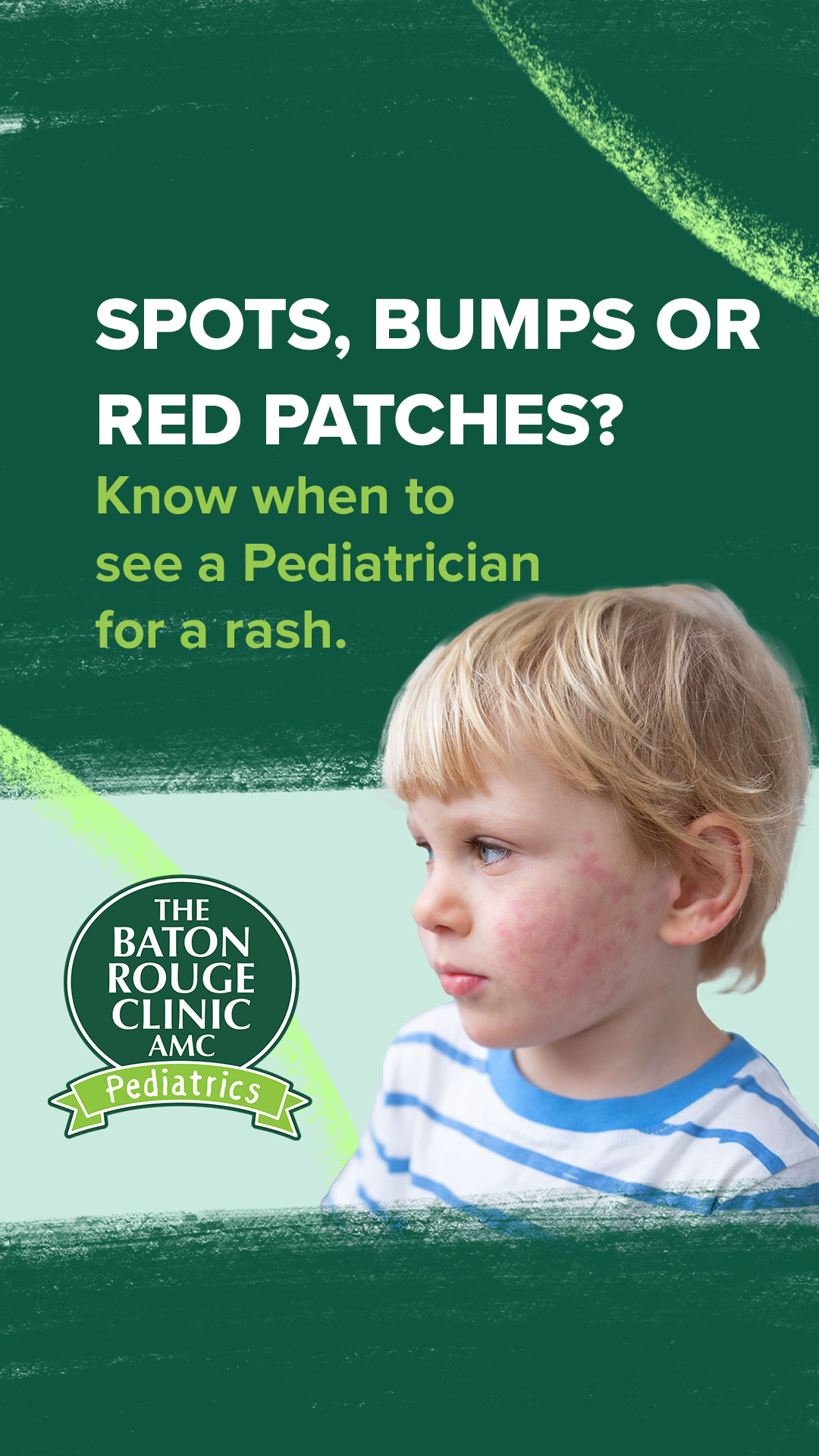 Is That Rash Contagious?