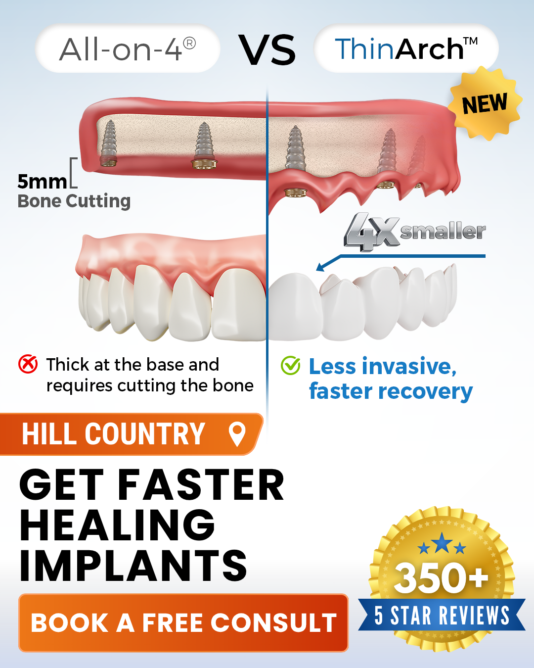 Precision Dentistry & Implants of Kerrville Implant Dentist ad creative
