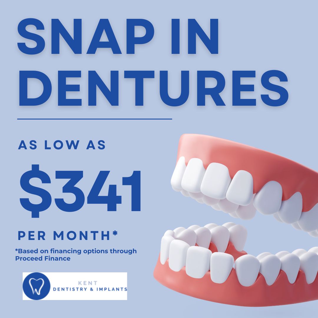 Snap-On Implant Dentures  🎉