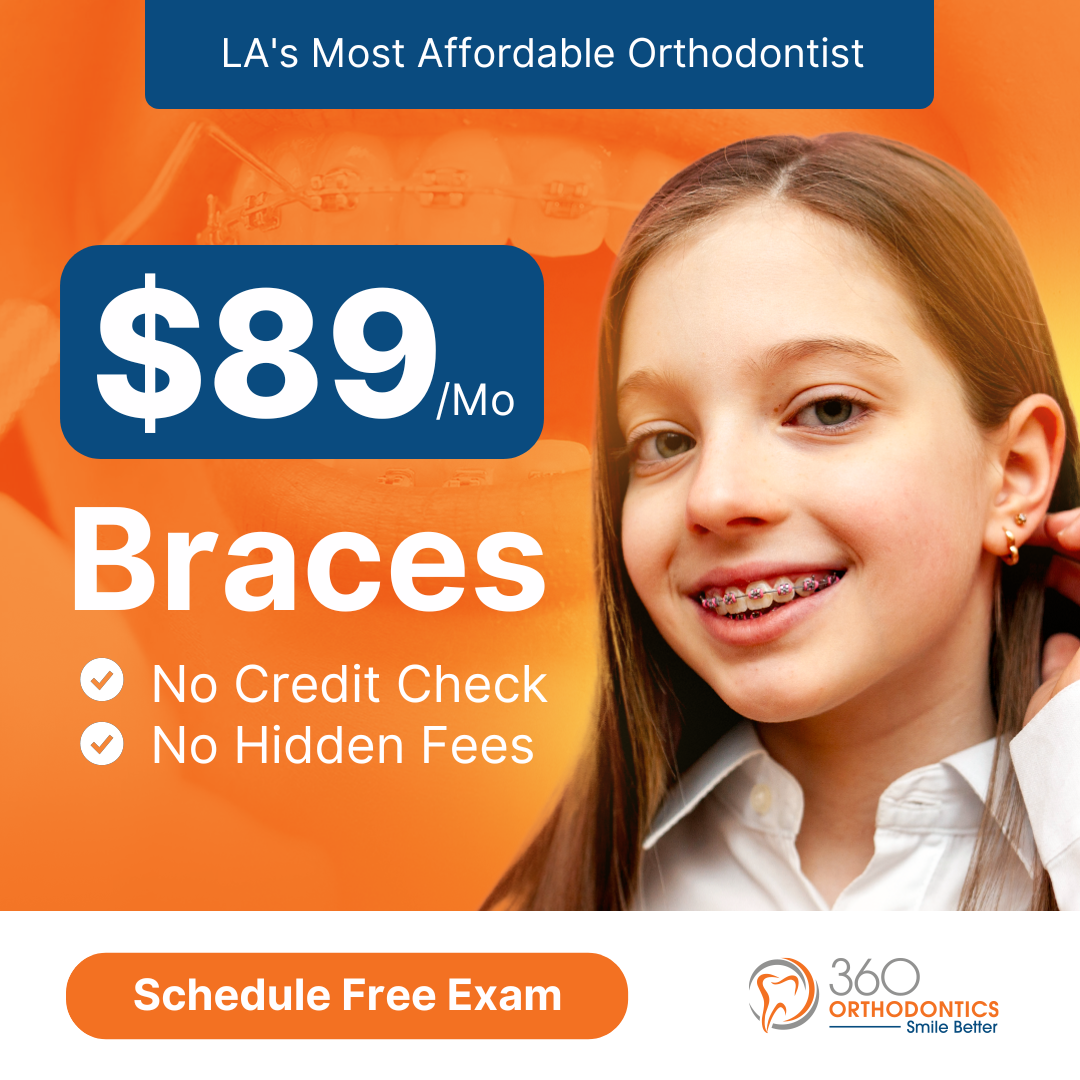 Braces For $89/Mo for a limited time only!