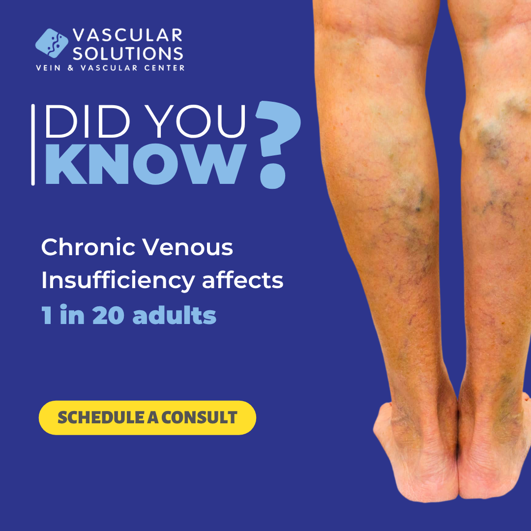 Is This Why Your Legs Hurt?