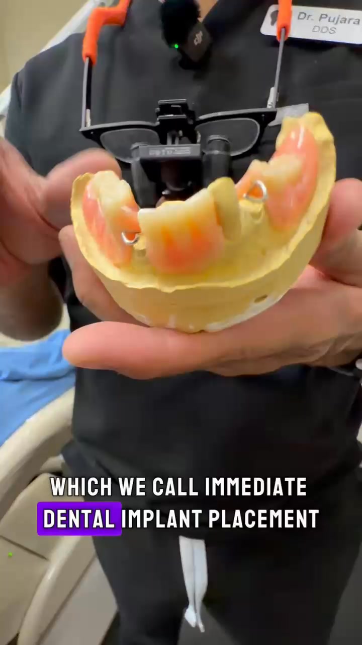 🚨 Not All Implants Are Created Equal 🚨