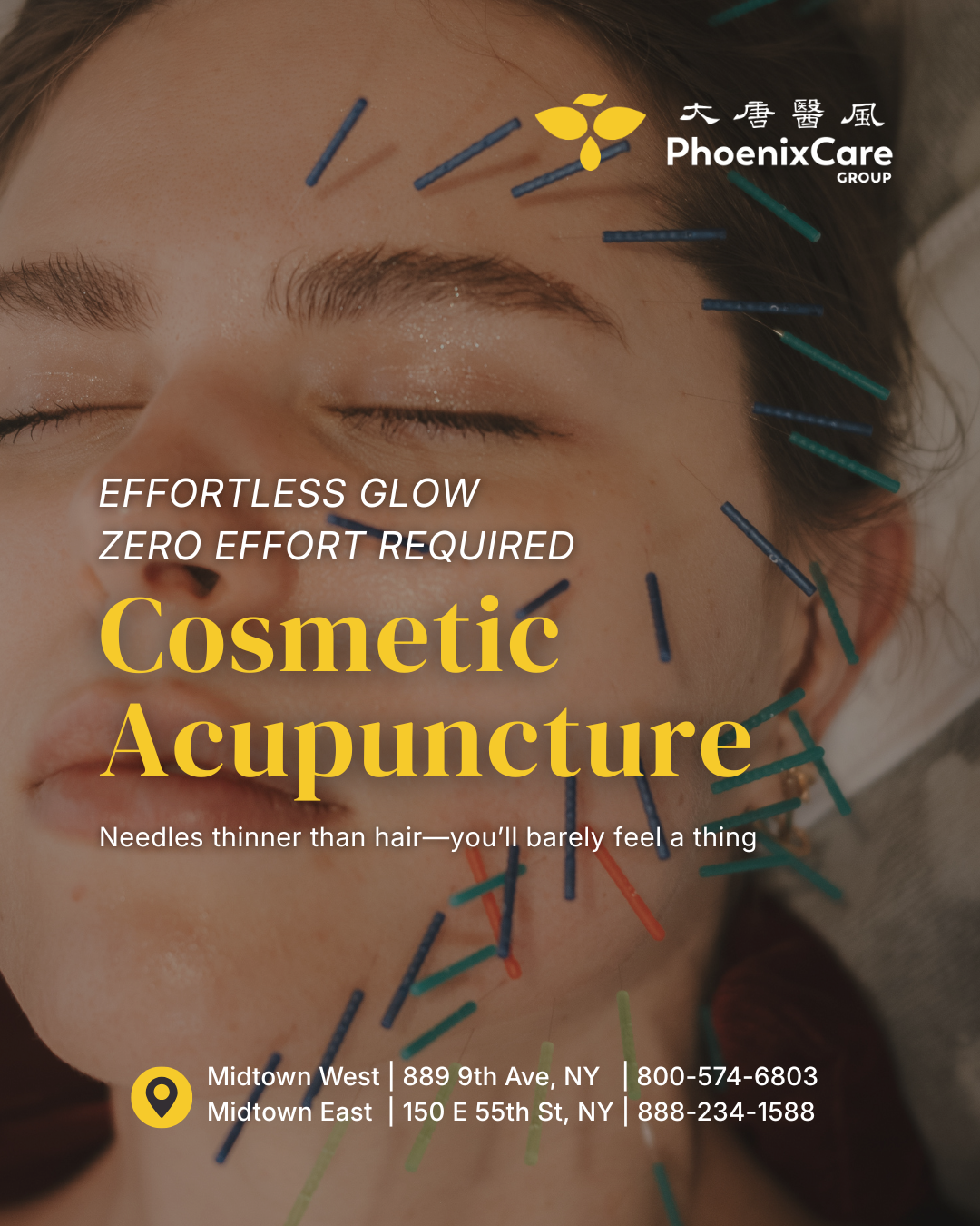 Holistic Cosmetic Acupuncture in NYC.