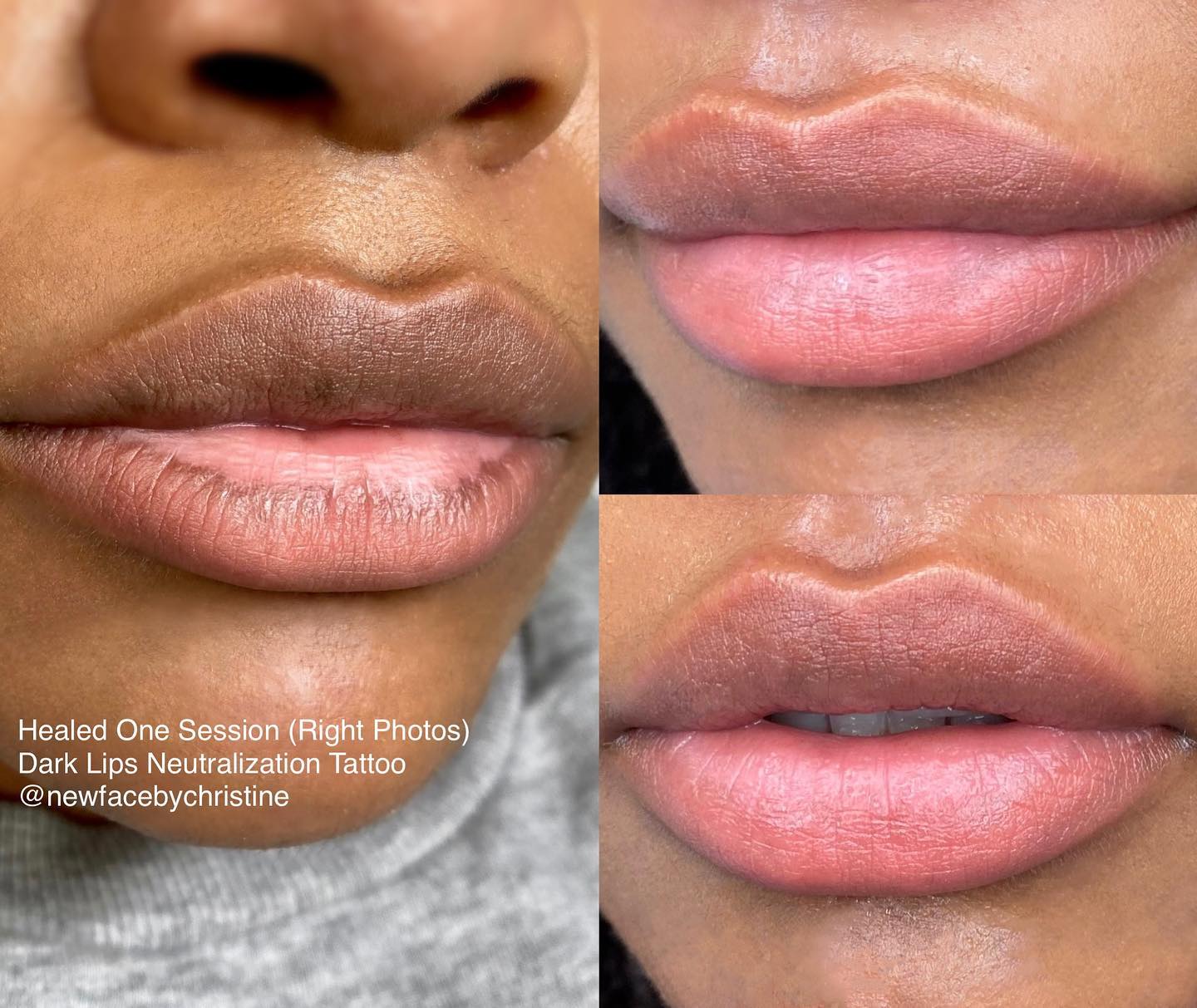 New Face by Christine Med Spa ad creative