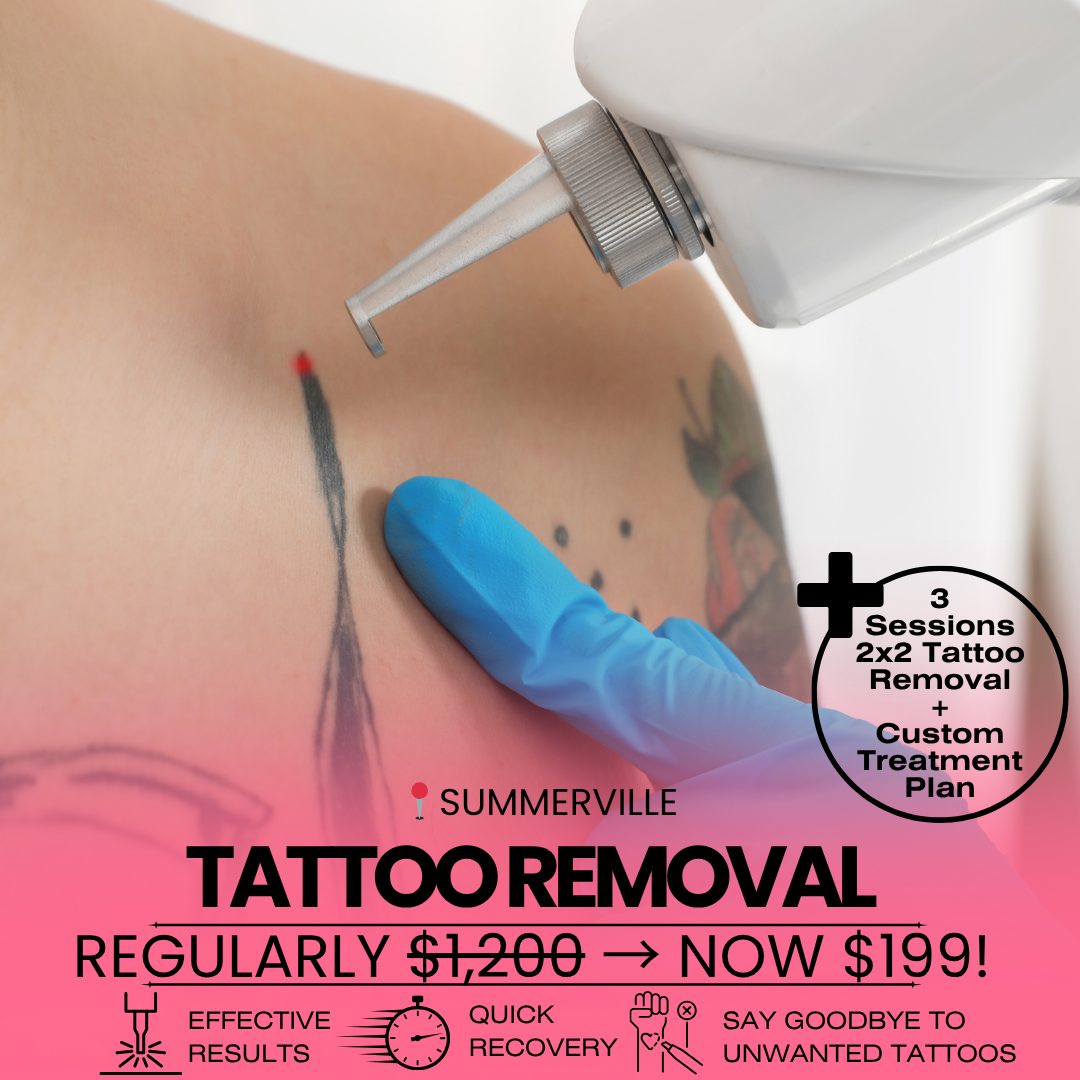 3 Tattoo Removal Sessions👉NOW $199!