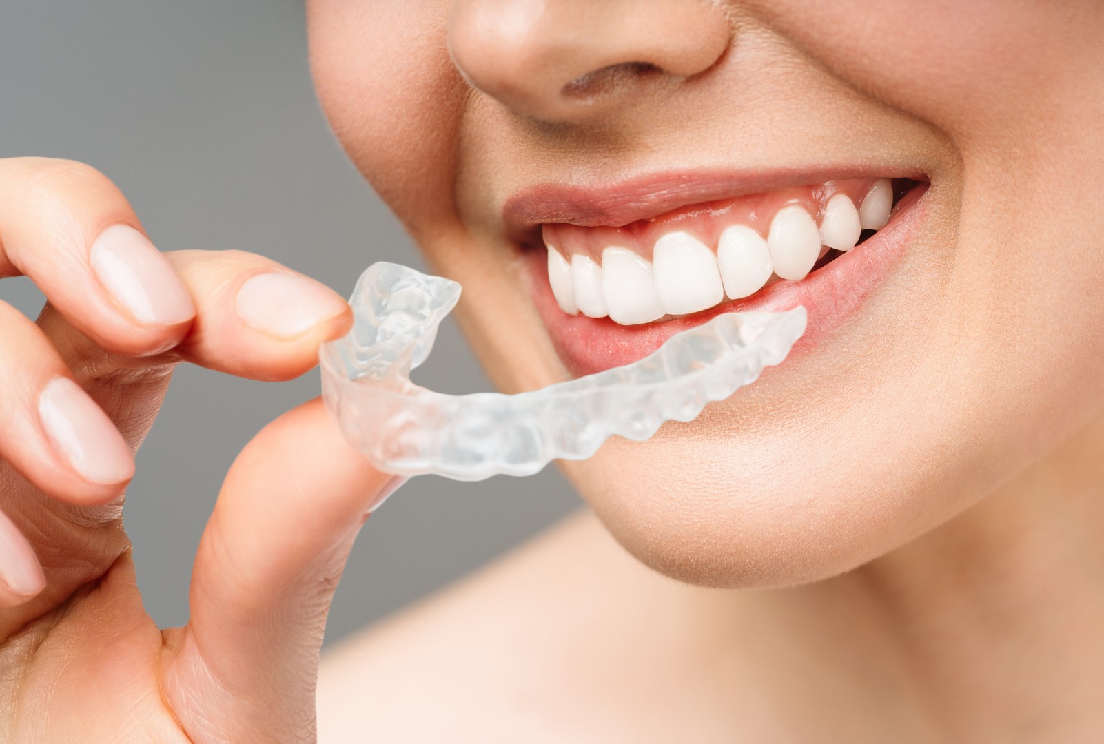 Save $500 on Invisalign! 🦷