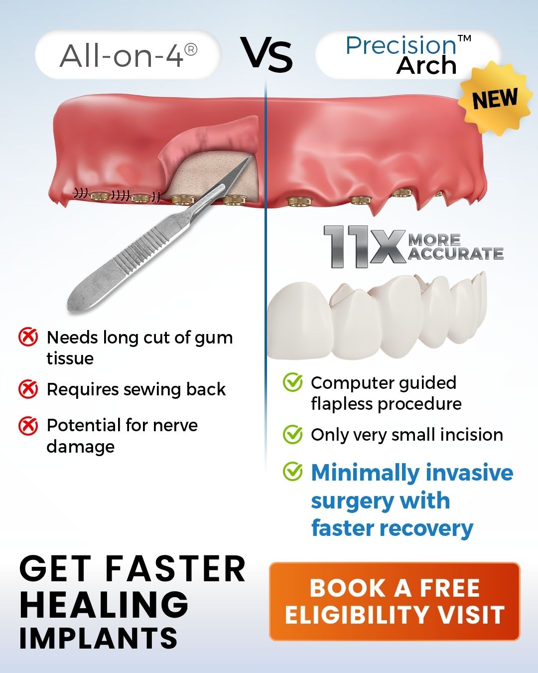 1 Day, 1 Place, $0 Down 👉 Receive Your Implant Price