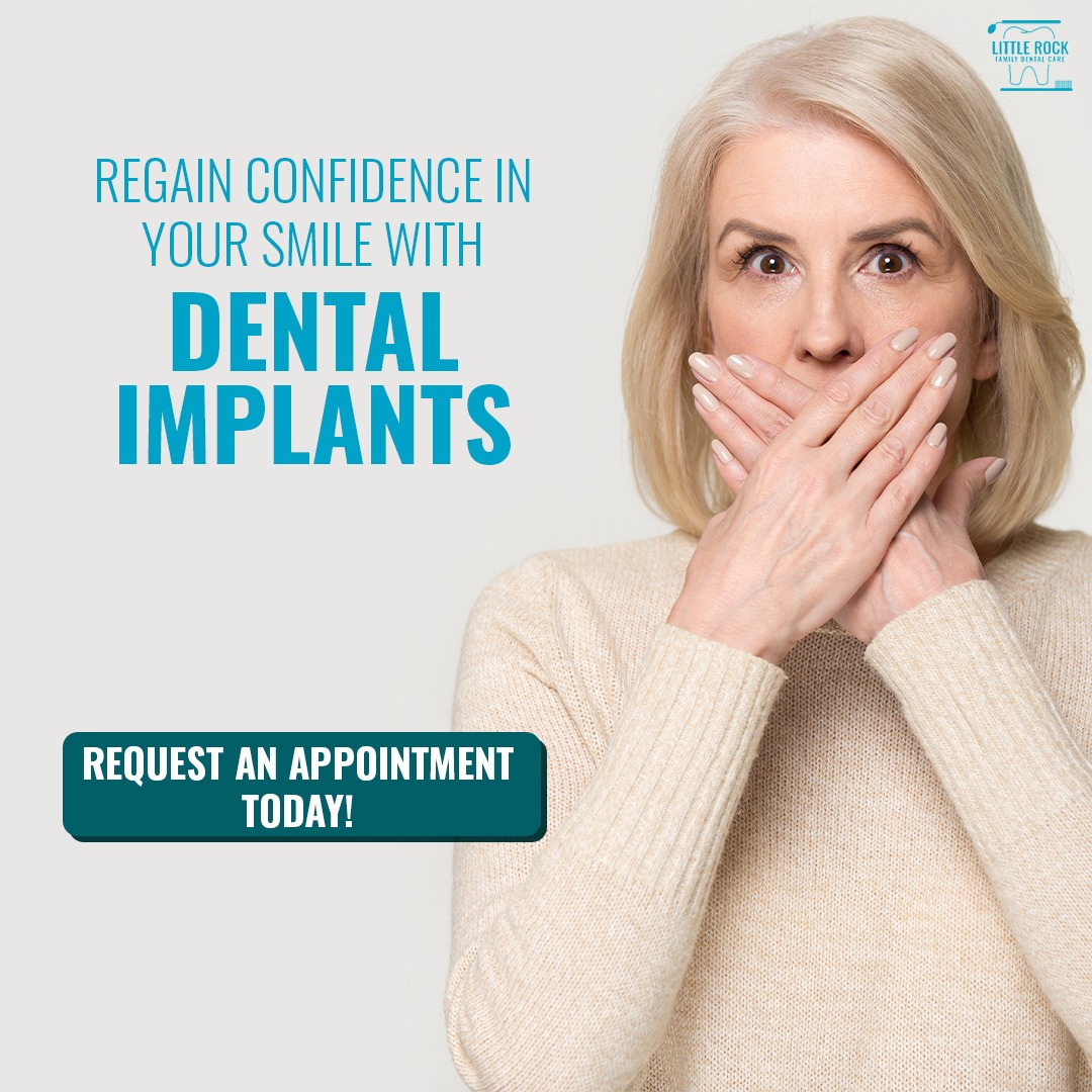 Take Our Implant Quiz! 👉