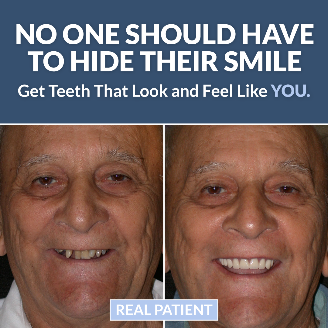 Find out if dental implants are right for you.