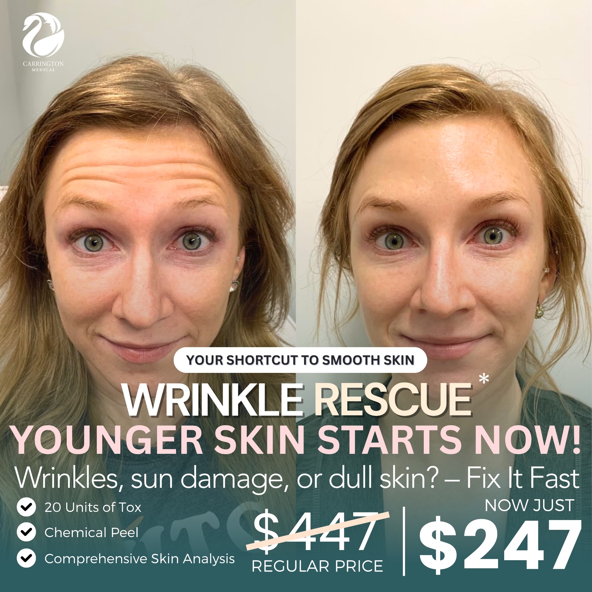 Carrington Medical Med Spa ad creative