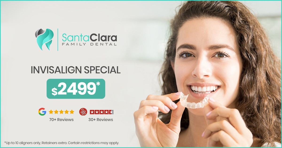 Santa Clara Family Dental Cosmetic Dentist ad creative